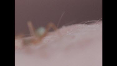 Ant biting person's skin