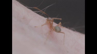 Hundreds of ants swarm over person and bite into skin. Zoom in to one ant with skin in mouth-parts.