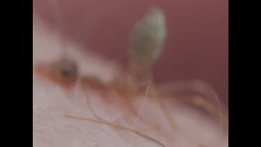 Ant biting person's skin