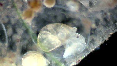 freshwater microscopic life