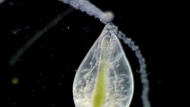 freshwater microscopic life