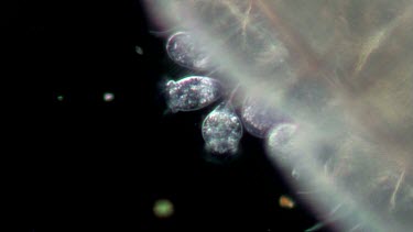 freshwater microscopic life