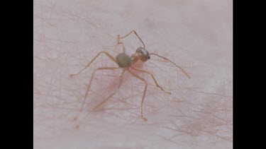 Ant biting person's skin