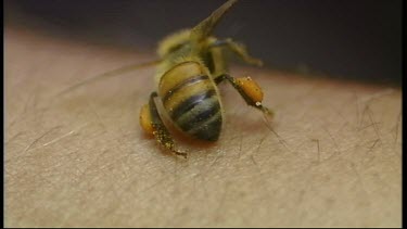 Bee Stinging Man's Arm