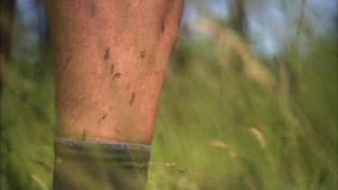 Close up of a golfers leg, ants are crawling on him.