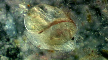 freshwater microscopic life